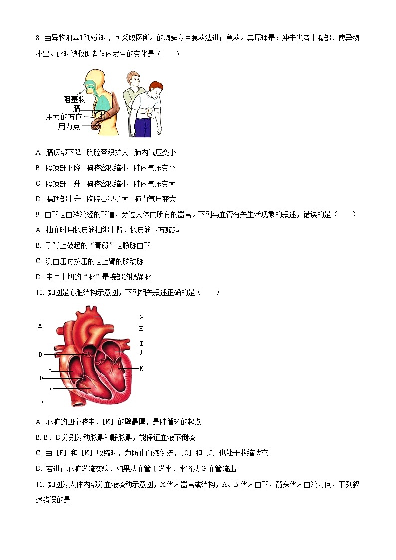 2024年山东省菏泽市郓城县多校联考中考一模生物试题(原卷版)03