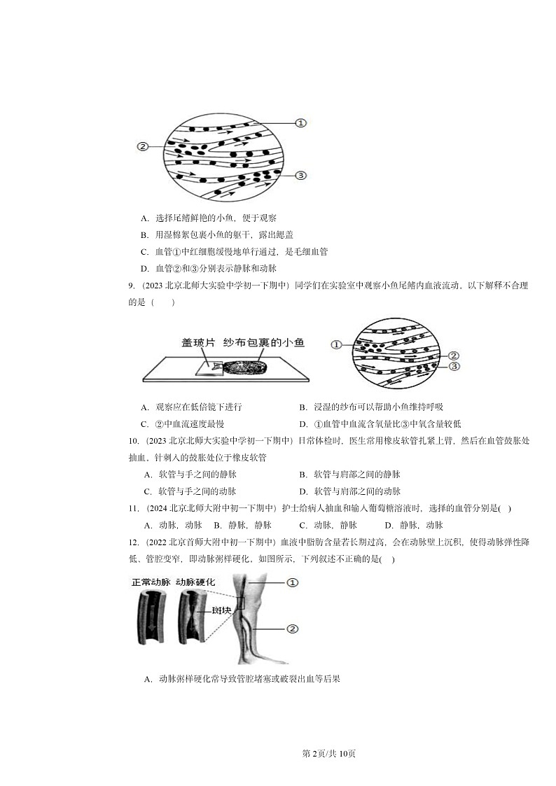 2022~2024北京重点校初一下学期期中真题生物分类汇编:血流的管道──血管第2页