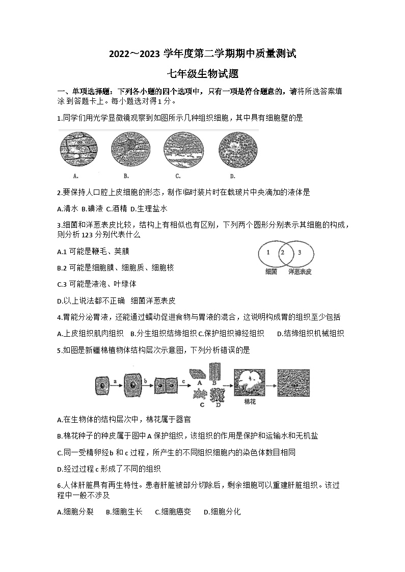 江苏省南通市启东市2022-2023学年七年级下学期期中考试生物试卷