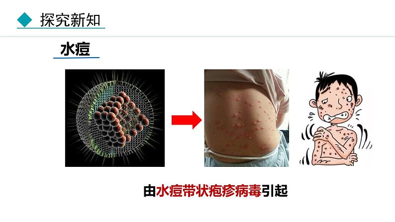 人教版(2024)八年级生物下册8.1.1传染病及其预防精品课件第7页