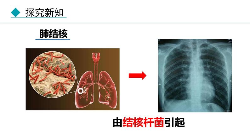 人教版(2024)八年级生物下册8.1.1传染病及其预防精品课件第8页