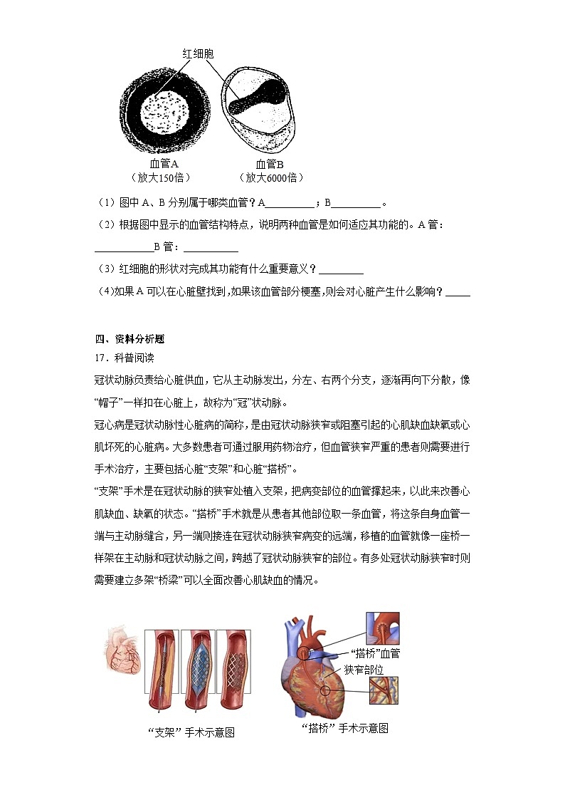 15.3当代主要疾病及其预防 同步练习 (含解析)生物八年级下册 京改版第3页