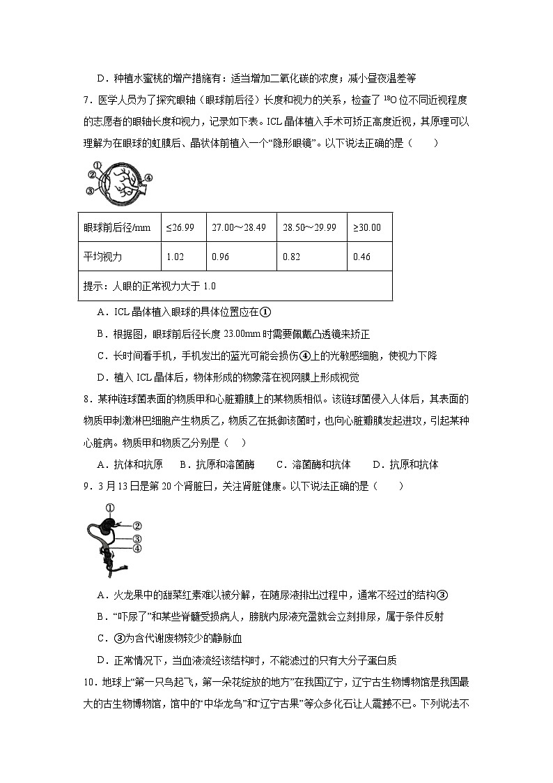2025年江苏省徐州市新沂市中考二模生物试题(附答案解析)第3页