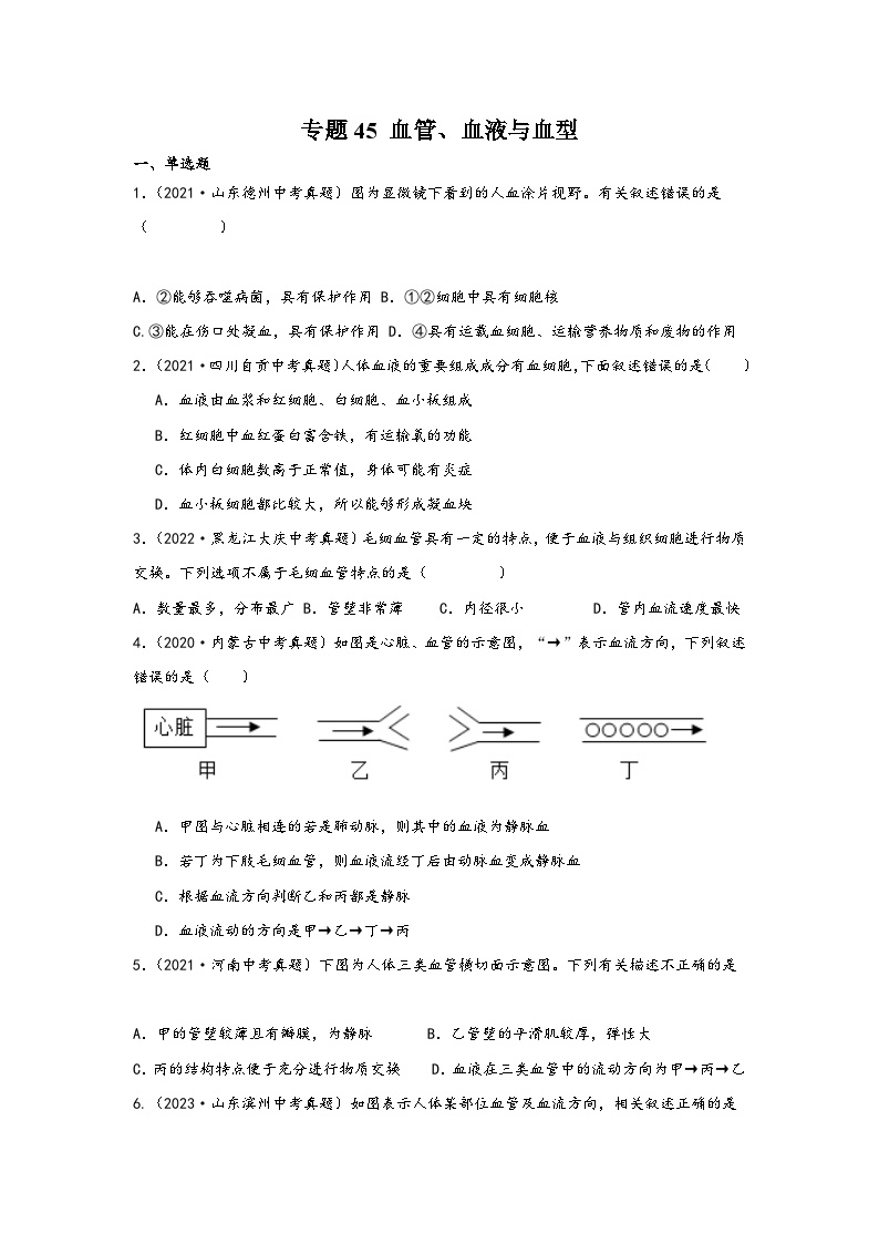 中考科学三年(2021-2023)真题分项汇编(浙江专用)专题45血管、血液与血型专题特训(原卷版+解析)