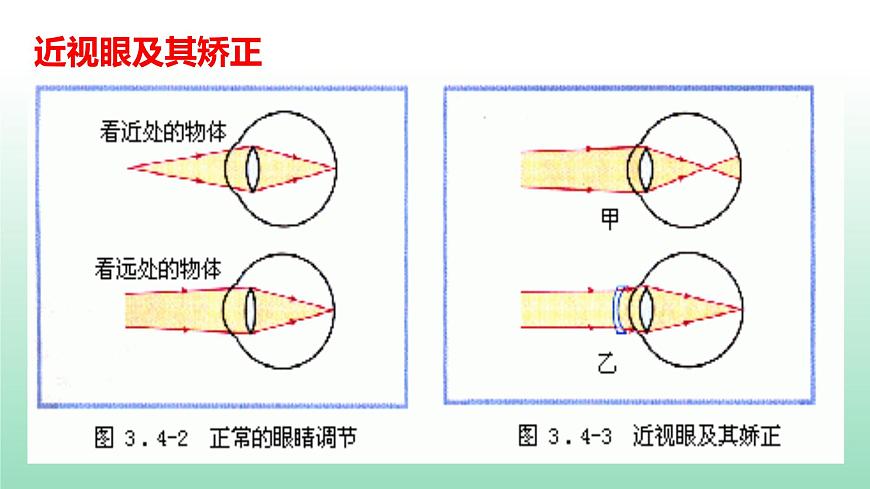 第五章第四節(jié)眼睛和眼鏡課件 人教版物理八年級上冊第8頁