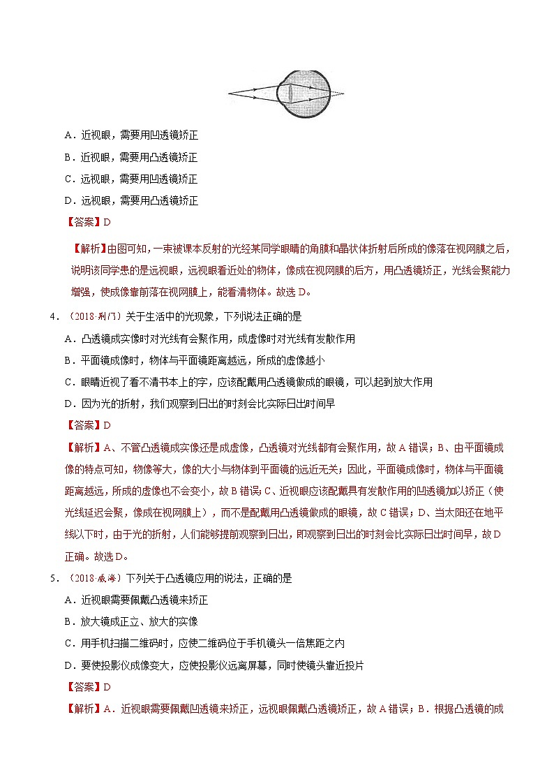 专题5.4 眼睛和眼镜-八年级物理人教版(上册)(解析版)第2页
