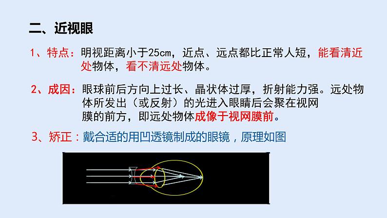 人教版八年级物理上册 5.4眼睛和眼镜 课件第7页