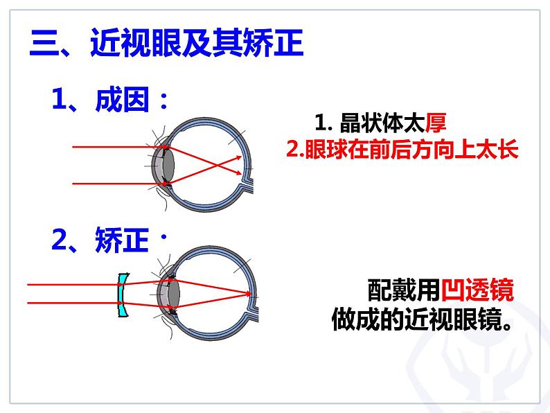 人教版物理《眼睛和眼镜》课件第7页
