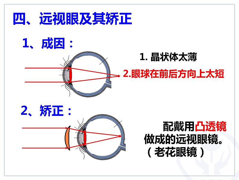 人教版物理《眼睛和眼镜》课件第8页