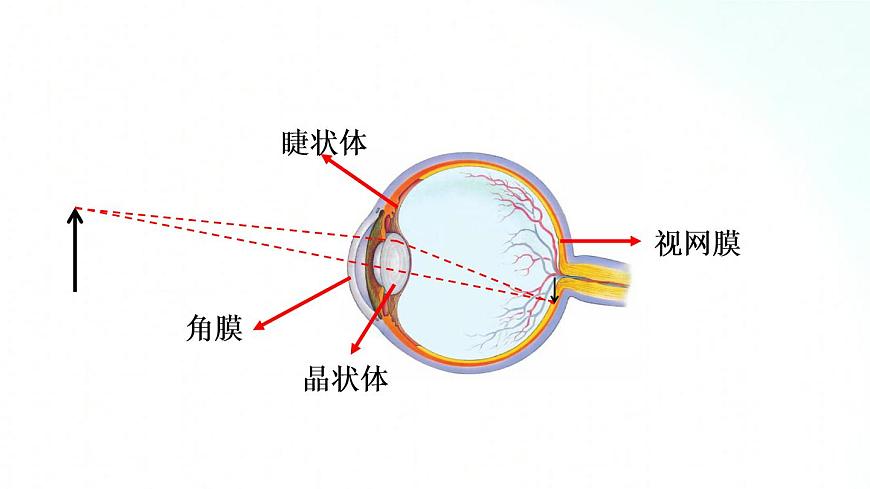人教版物理八年級上冊 5.4 眼睛和眼鏡 課件第4頁