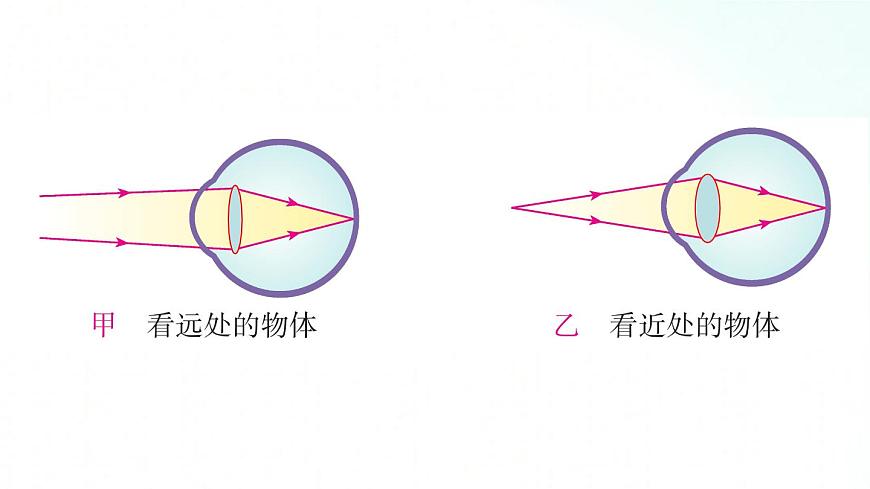 人教版物理八年級上冊 5.4 眼睛和眼鏡 課件第6頁
