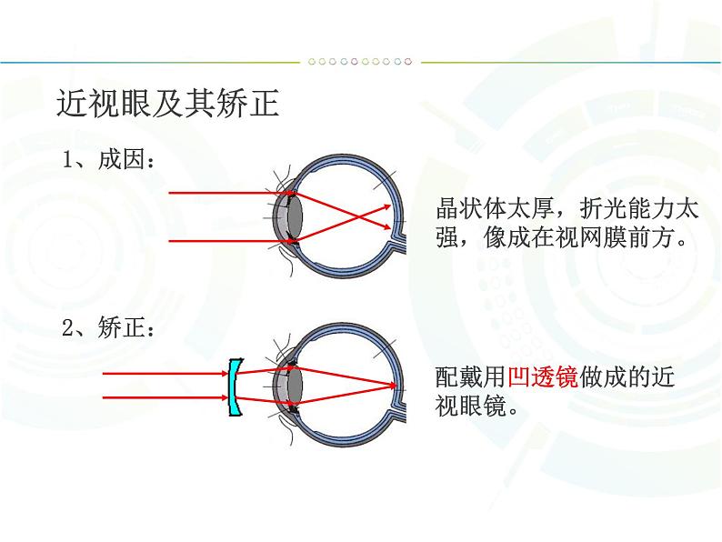 人教版八年级物理上册-5.4眼睛和眼镜-课件第6页