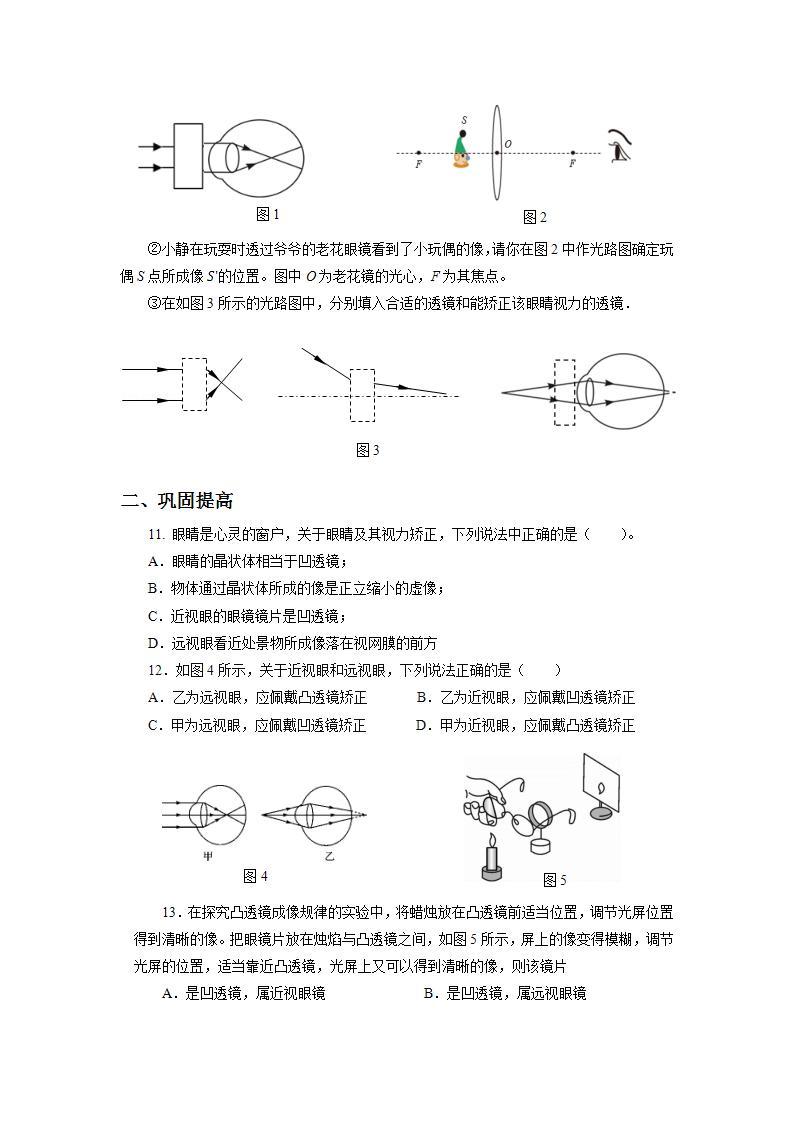 人教版八上物理 5.4 眼睛和眼镜 练习【原卷版+解析版】03