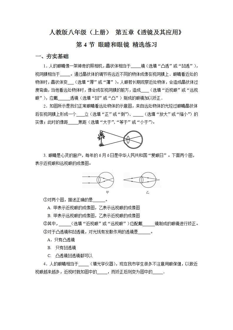人教版八上物理 5.4 眼睛和眼镜 课件+内嵌式视频+练习(原卷版+解析版)01