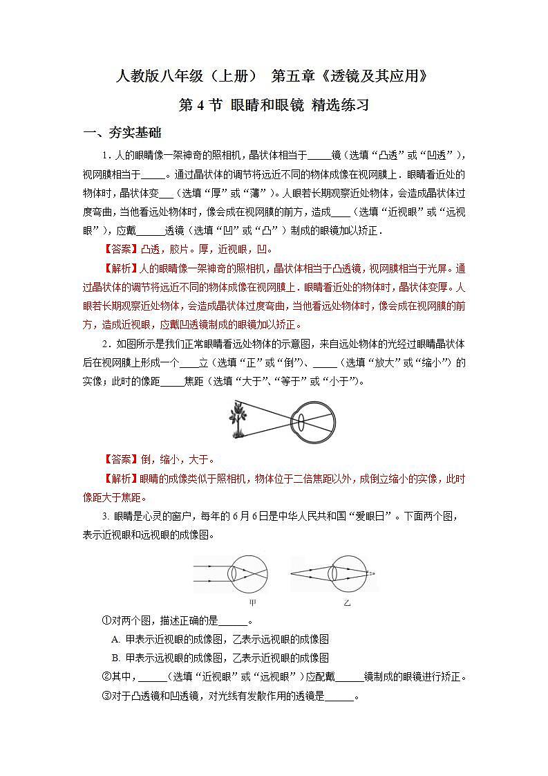 人教版八上物理 5.4 眼睛和眼镜 课件+内嵌式视频+练习(原卷版+解析版)01