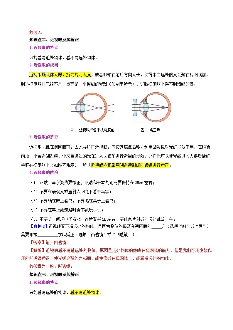 【同步讲义】人教版物理八年级上册-课时5.4 眼睛和眼镜 讲义03