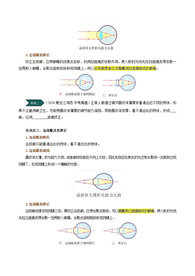 人教版2024-2025學(xué)年八年級(jí)物理上冊(cè)同步精品講義專(zhuān)題5.4眼睛和眼鏡(學(xué)生版+解析)第3頁(yè)