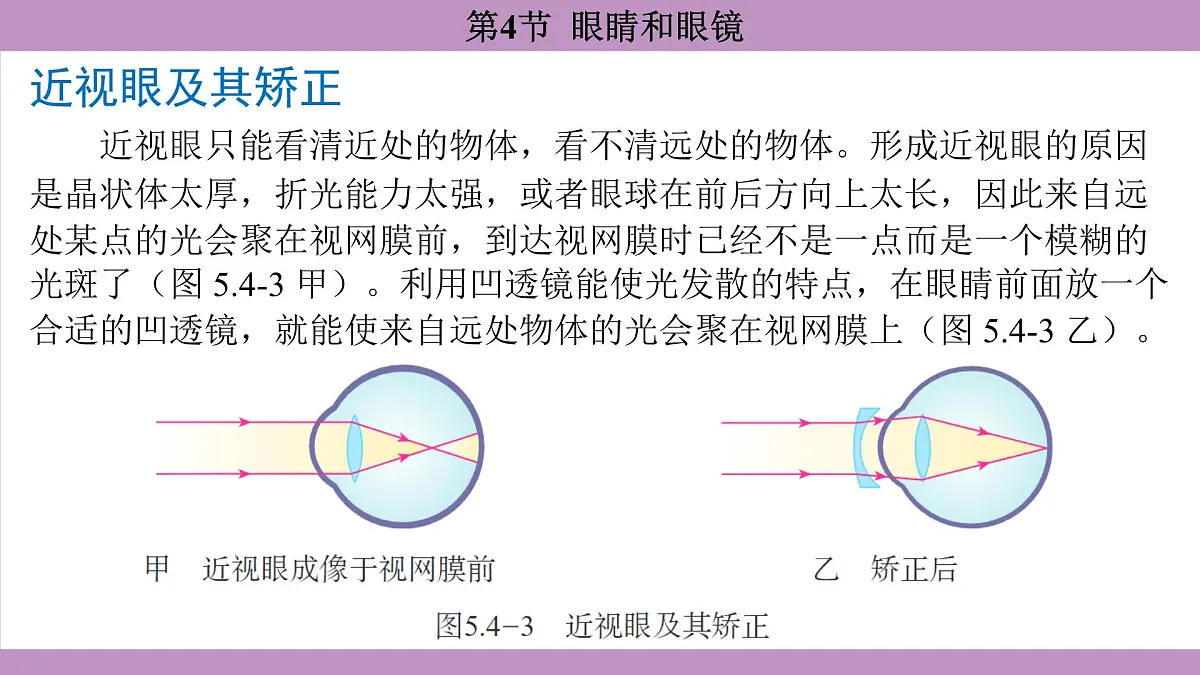 5.4 眼睛和眼镜(课件)---2024-2025学年人教版物理八年级上册第7页