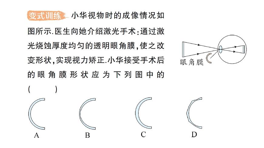 初中物理新人教版八年級上冊第五章第四節(jié) 眼睛和眼鏡作業(yè)課件2024秋第6頁