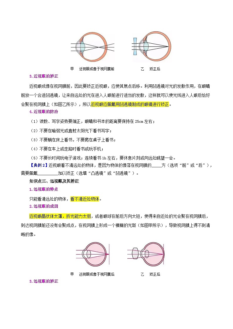 課時(shí)5.4  眼睛和眼鏡（眼睛版）第3頁(yè)