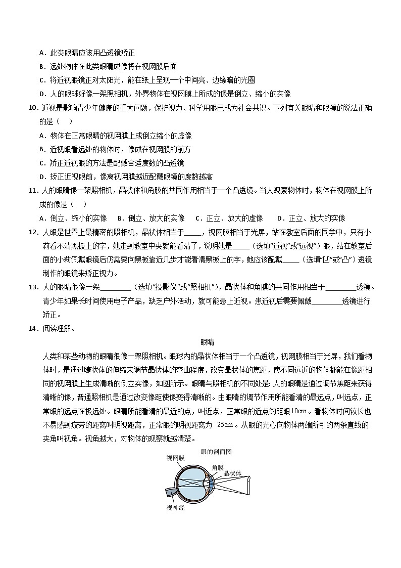 第4节 眼睛和眼镜(重难点训练)初中物理人教版(2024)八年级上册 第五章 透镜及其应用(原卷版)第3页