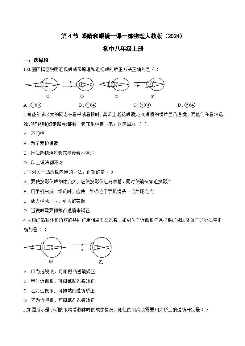第4节 眼睛和眼镜一课一练物理人教版(2024)初中八年级上册(无答案)第1页