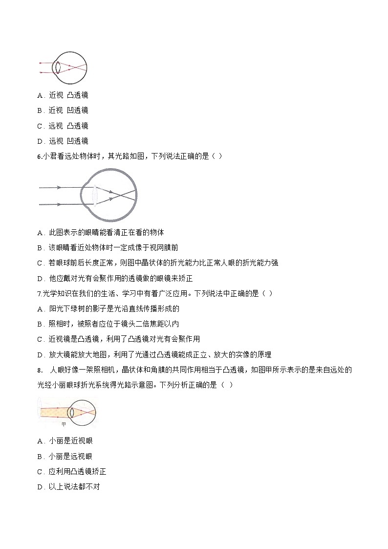 第4节 眼睛和眼镜一课一练物理人教版(2024)初中八年级上册(无答案)第2页