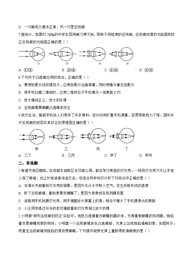第4节 眼睛和眼镜一课一练物理人教版(2024)初中八年级上册(无答案)第3页
