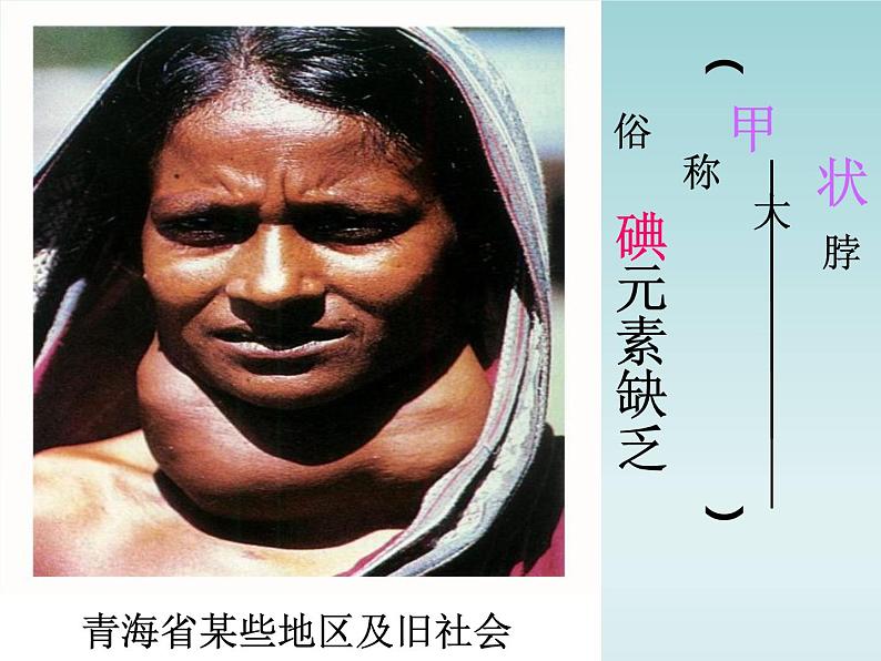 人教五四制初中化学九年级全册《第五单元 课题2 化学元素与人体健康》课件PPT03