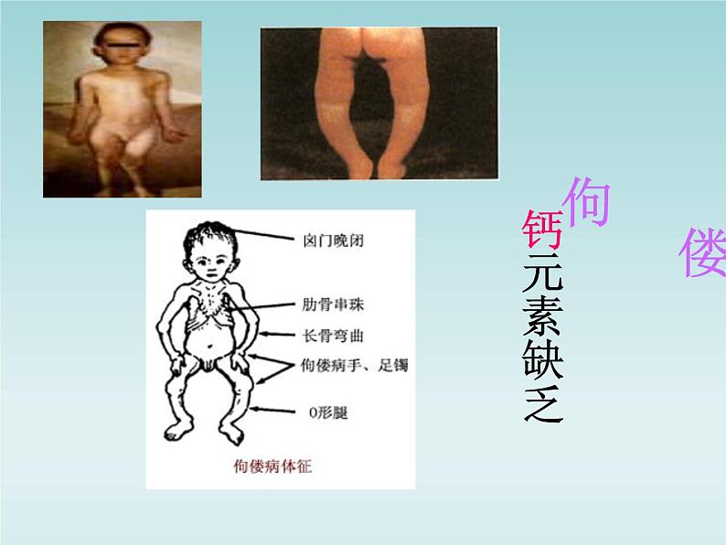 人教五四制初中化学九年级全册《第五单元 课题2 化学元素与人体健康》课件PPT04
