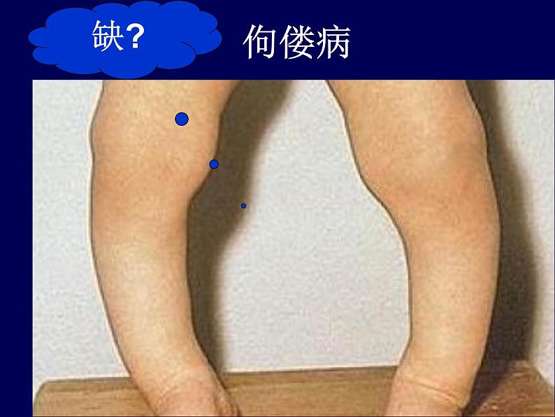 鲁教版九年级下册化学 10.2化学元素与人体健康 课件第7页
