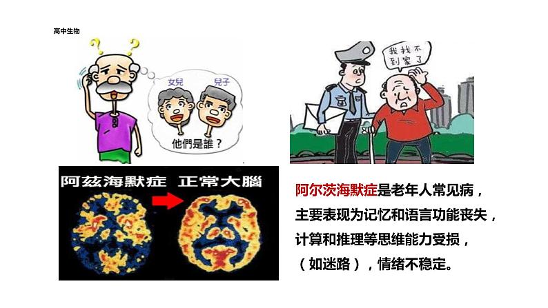 2021-2022学年高中生物新人教版选择性必修1 第2章 第5节 人脑的高级功能 课件(20张)第3页