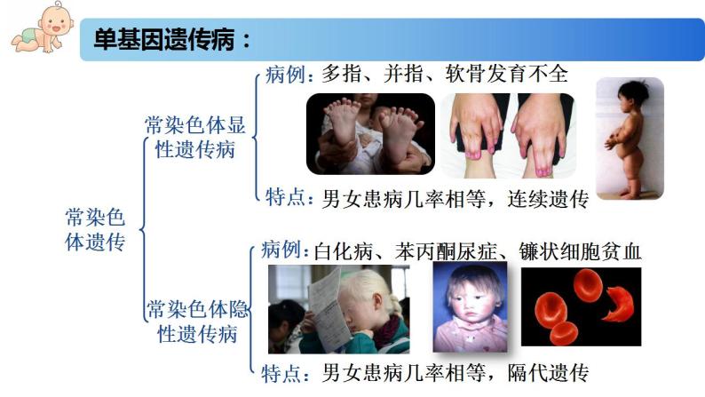 3.3 人类遗传病-2020-2021学年高一生物同步备课系列（新苏教版（2020）必修2）课件PPT06