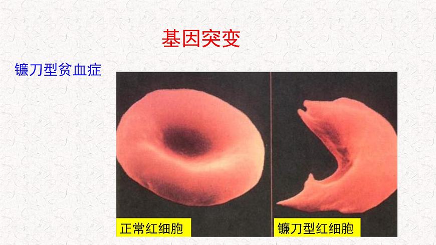 4.1 基因突變可能引起性狀改變 課件-浙科版高中生物必修2遺傳與進化(共22張PPT)第6頁