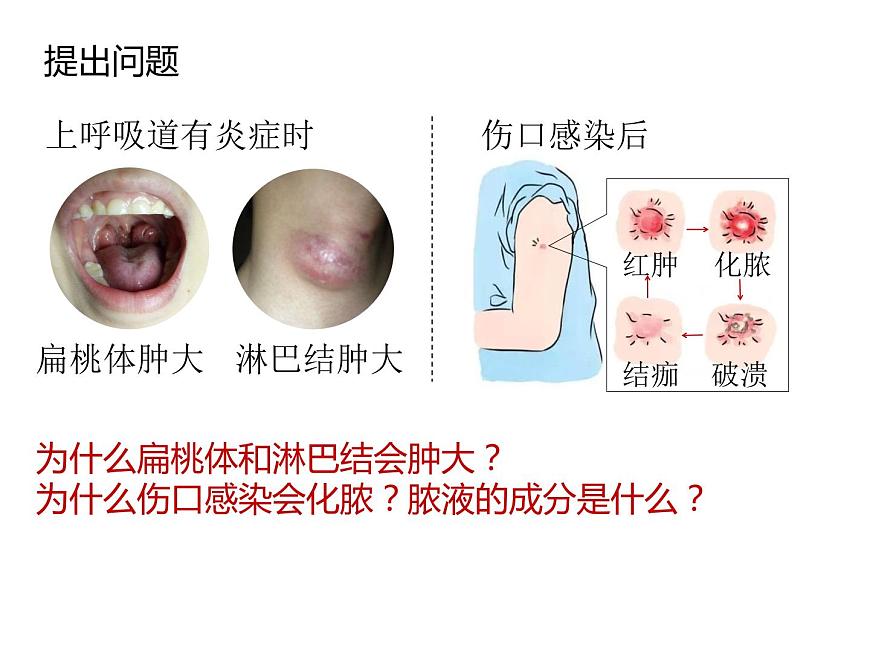 人教版(2019)高二生物選擇性必修1-4.1免疫系統(tǒng)的組成和功能課件PPT第4頁