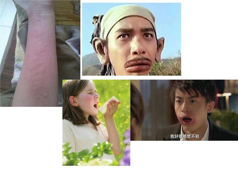 人教版(2019)高二生物选择性必修1-4.3免疫失调课件PPT第3页