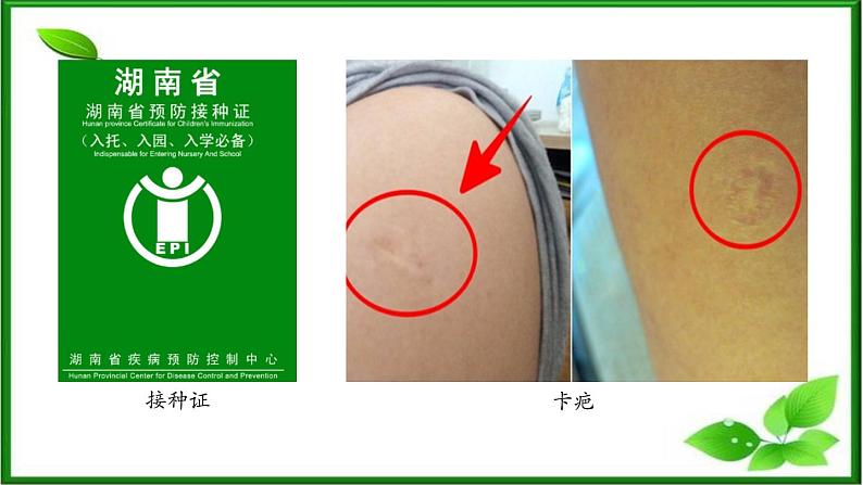 4.4免疫学的应用课件2021-2022学年高二上学期生物人教版选择性必修1第3页