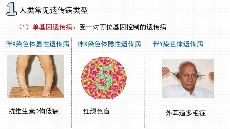 5.3 人类遗传病课件PPT第6页