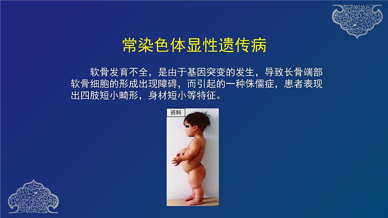 部编生物必修第2册(课件)15 人类遗传病06