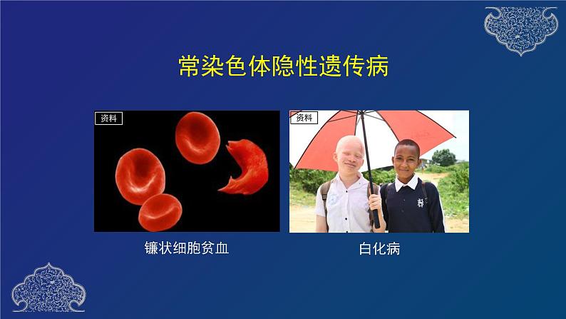 部编生物必修第2册(课件)15 人类遗传病08