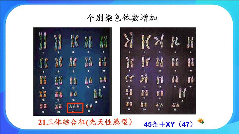 (课件)染色体畸变可能引起性状改变.ppt第3页