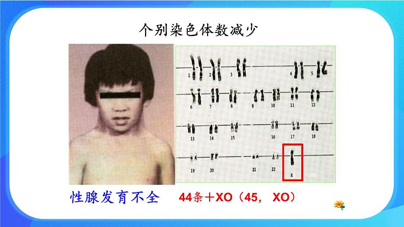 (课件)染色体畸变可能引起性状改变.ppt第4页