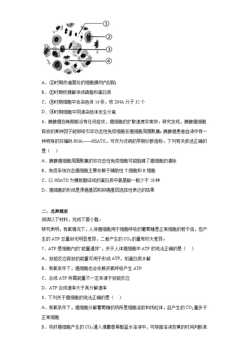 2023届浙江省绍兴市上虞市高三第二次适应性考试生物试题（含解析）02