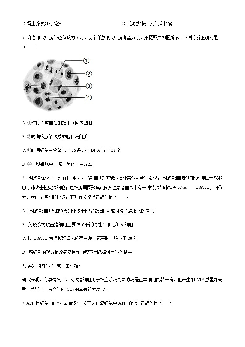 2023届浙江省绍兴市上虞市高三第二次适应性考试生物试题含解析02