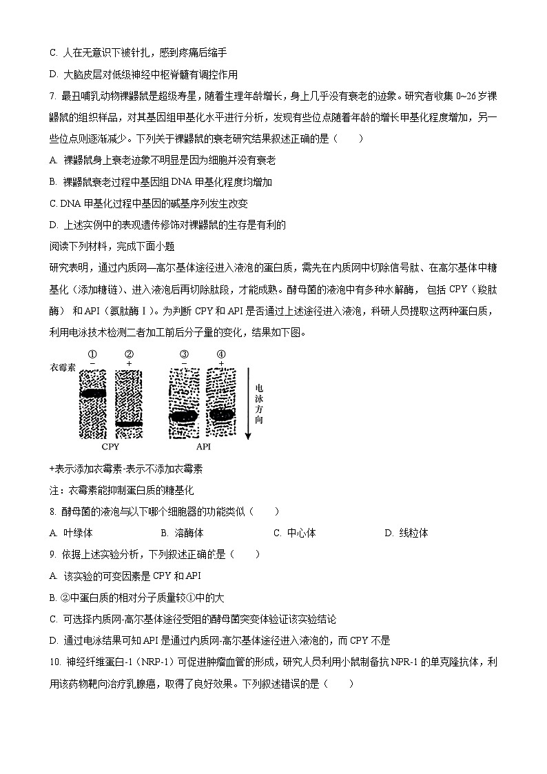 2023台州高二下学期期末考试生物试题含解析02