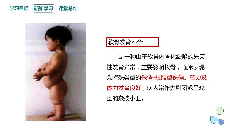 4.4 人类遗传病是可以检测和预防的 课件 2023-2024学年高一生物浙科版(2019)必修207