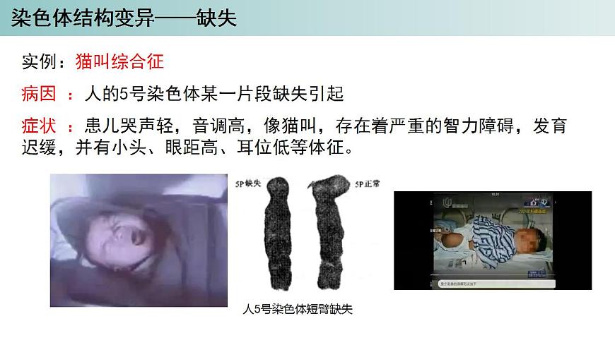 2023-2024學年浙科版（2019）必修2 4.3染色體畸變可能引起性狀改變（第1課時）課件第5頁