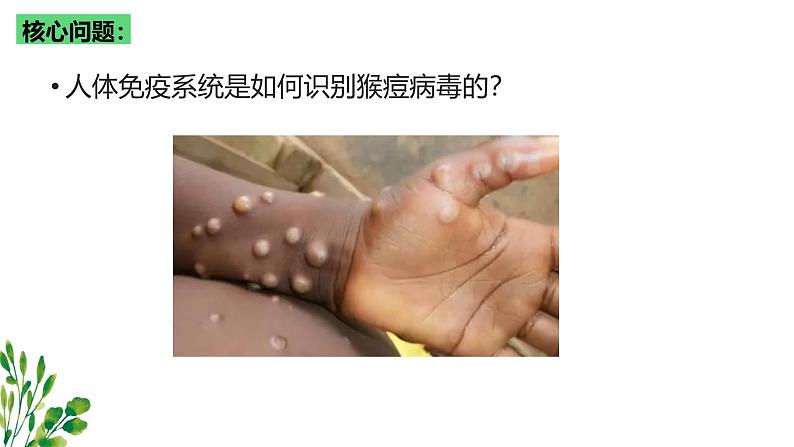 浙教版2019高二生物选择性必修1 4.1免疫系统识别“自己”和“非己” 课件第5页