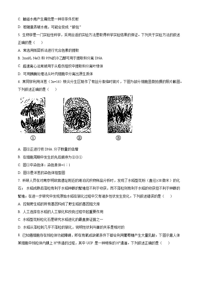 浙江省七彩阳光新高考研究联盟2024-2025学年高三上学期8月开学考试生物试题(Word版附解析)02