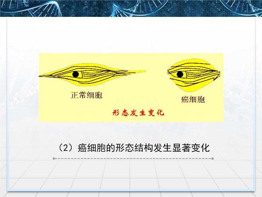 人教版 (新課標)高中生物 必修1 6-4《細胞的癌變》課件第7頁